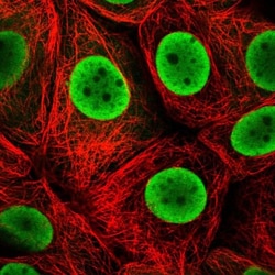 HDGF Antibody, Novus Biologicals 0.1mL; Unlabeled:Antibodies, Polyclonal